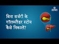 बिना सर्जरी के गॉलब्लैडर स्टोन कैसे न�