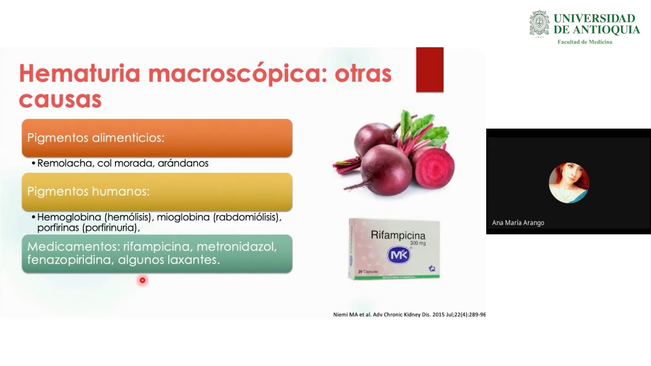Enfoque del Paciente con Hematuria y Proteinuria - Dra. Ana Maria Arango