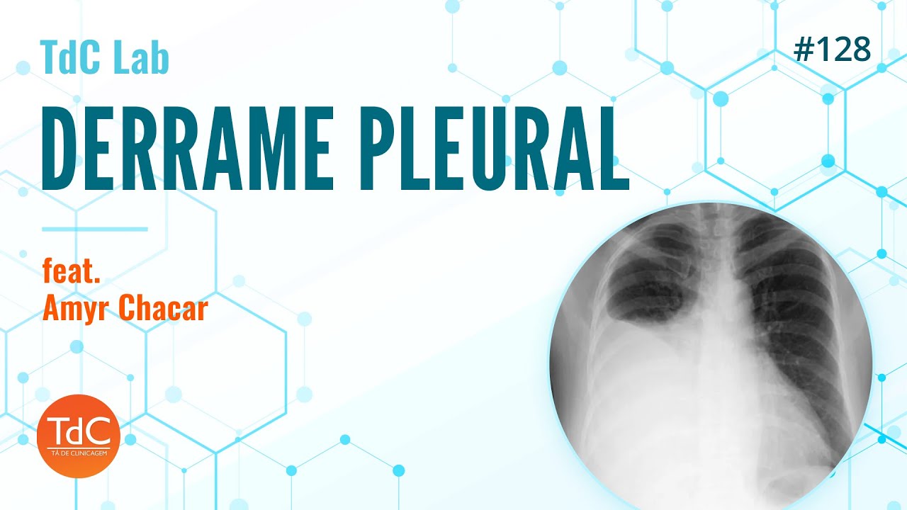 Derrame Pleural: Episódio 128 - TdC Lab
