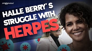 Why Was Halle Berry Taken Aback By her Herpes Diagnosis?