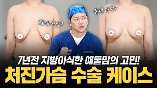 처진가슴, 탄력있게 올리는 방법! 지방이식? 확대거상? '이것' 하세요! 실제 환자 케이스 리뷰