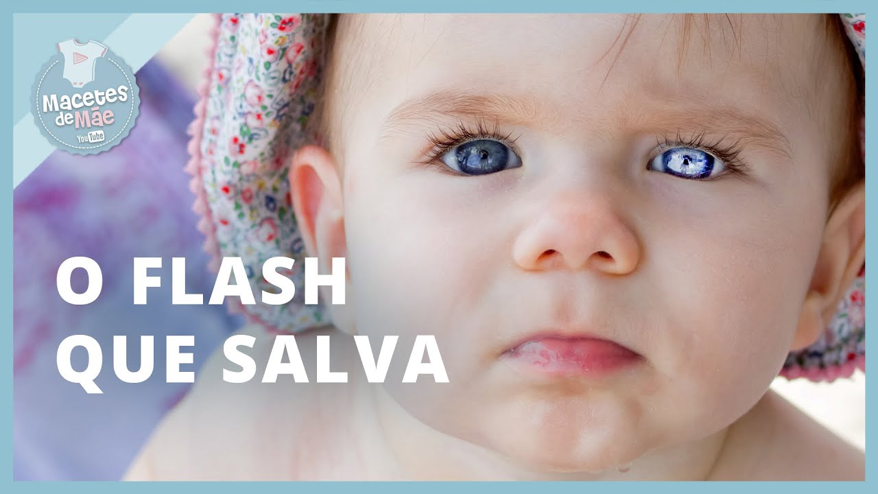 RETINOBLASTIMA: UM FLASH PODE REVELAR CÂNCER DE OLHO | MACETES DE MÃE