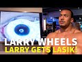 LASER EYE SURGERY