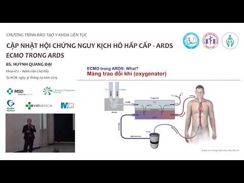 Cập nhật hội nguy kịch hô hấp cấp (ARDS) #5 - ECMO em ARDS