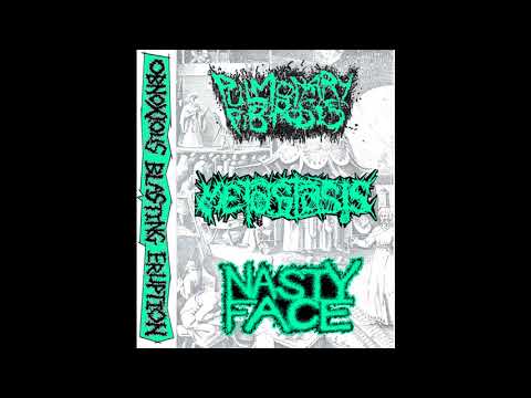 Pulmonary Fibrosis / Metastasis / Nasty Face - Obnoxious Blasting Eruption 3 way split