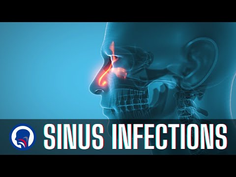 Understanding Sinus Infections | Capital ENT & Sinus Center