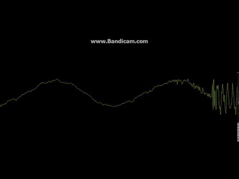 Zil Sesi [NATAN feat ТИМАТИ! СЛЫШЬ,ТЫ ЧЁ ТАКАЯ ДЕРЗКАЯ,А? КЛИП!]