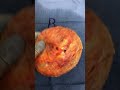 Breast Implant Illness Miami Surgeon Displays Removed Implants WARNING GRAPHIC