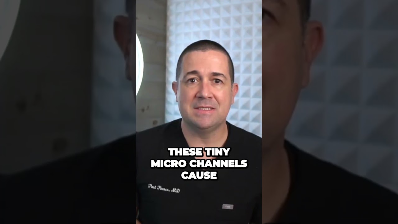 PRP Injection Technique Is Important