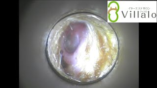 耳掃除動画vol.31「vol.8のお客様 3回目のご来店」