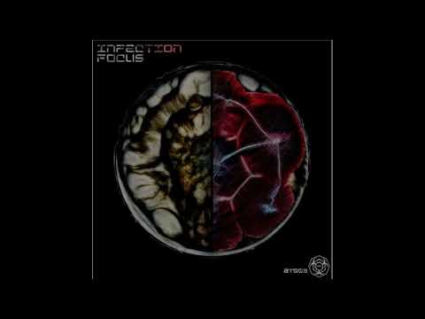 Masso - ARN Decoded. Techno