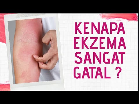 Kenapa EKZEMA SANGAT GATAL ?