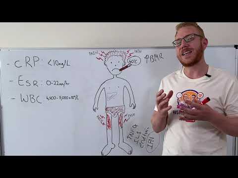 Systemic effects of inflammation