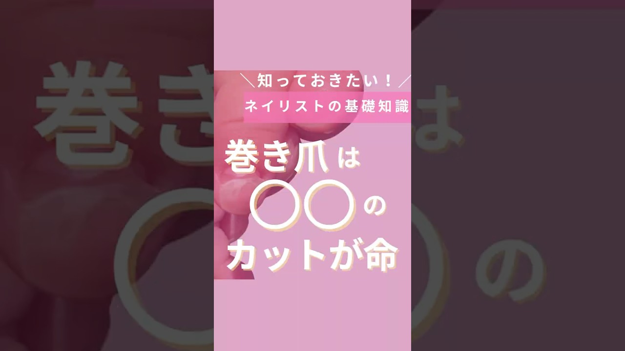 巻き爪は○○のカットが命！