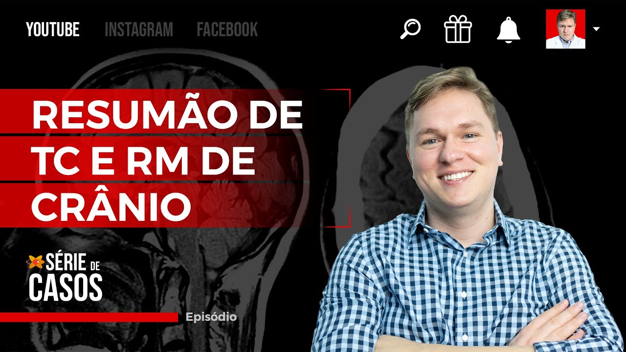 AVALIAÇÃO POR IMAGEM DO CRÂNIO - ANATOMIA E PATOLOGIAS