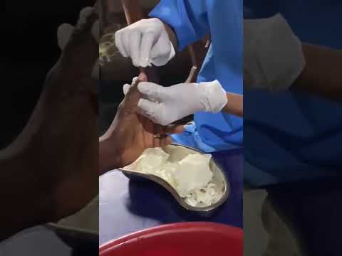 Nail Care Exercise