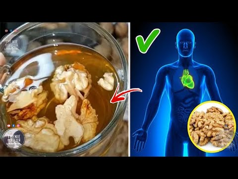 Lërini 8 orë në ujë arrat para se t’i konsumoni, do ngeleni pa fjalë me atë që do t’i ndodhë trupit