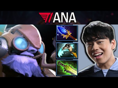 Tinker Dota 2 Gameplay T1.Ana with 22 Kills and Epic Fast Hands