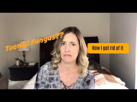 Tulad ng isang popular na paraan upang mapupuksa ng halamang-singaw paa Paggamot ng kuko halamang-singaw detergent review