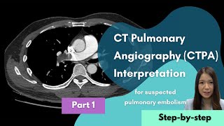 CT Pulmonary Angiography (CTPA) Interpretation - Part 1