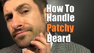 How To Deal With A Patchy Beard | Bald Spot Reduction Tips
