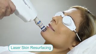Laser Skin Resurfacing NYC - Clear Lift