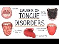 Understanding Tongue Disorders: Causes and Management