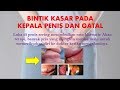 Top BINTIK KASAR PADA KEPALA PENIS DAN GATAL, terbaru!