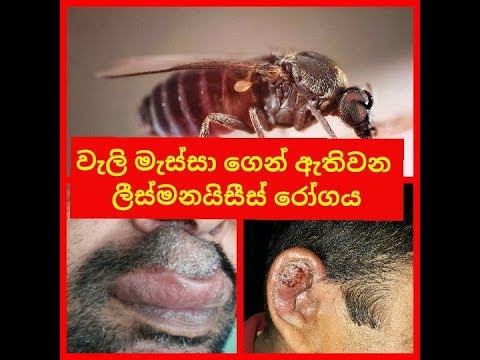 මේ දිනවල දිවයින පුරා  සීග්‍රයෙන්  පැතිරී යන වසංගතය  "ලීස්මනයිසීස්" csaratv