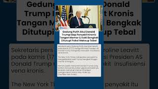 Gedung Putih Akui Donald Trump Idap Penyakit Kronis, Tangan Memar & Kaki Bengkak Ditutupi Makeup