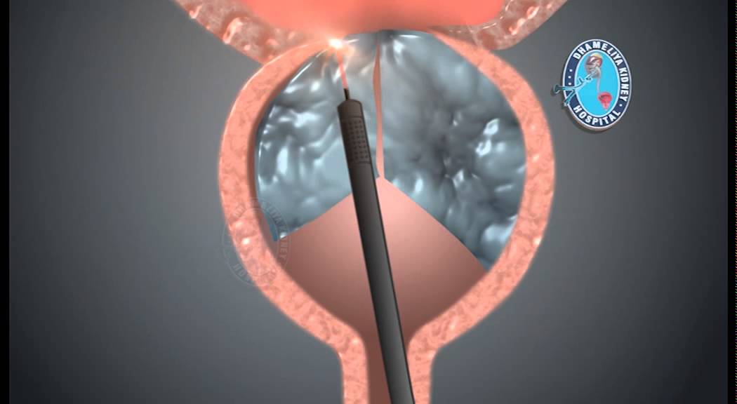 Roberto Carlos Castañeda Caballero-27