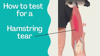 Torn Hamstrings & Glutes - This is how you test them...
