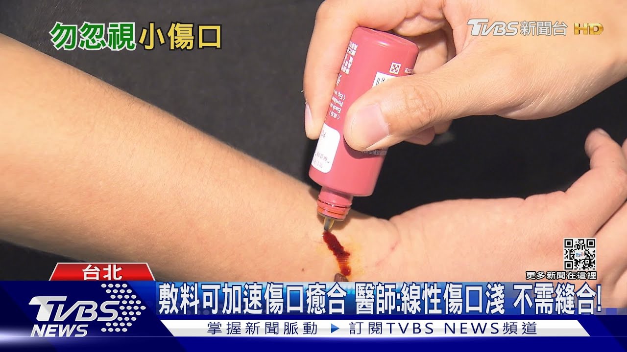 輕忽小傷口自行換藥!留下疤痕整形外科醫師擔憂 發生這件事