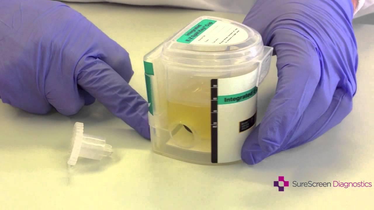 How To Drug Test Using a SureScreen Integrated Cup