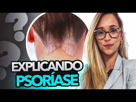 Psoríase - O Que é, Causas e Sintomas da Psoríase