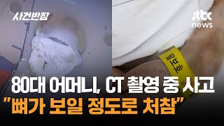 Download lagu 80대 어머니, CT 촬영 중 사고…'뼈가 보일 정도로 처참' / JTBC 사건반장 mp3