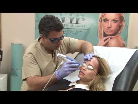 クリア+ブリリアントで表面を覆うレーザー皮膚 - クリストファー・コーサンディ医師 - ラスベガス, NV (Laser Skin Resurfacing With Clear + Brilliant - Dr. Christopher Khorsandi - Las Vegas, NV)