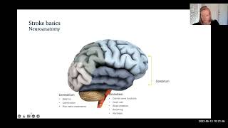 NIH Stroke Scale - Tips, Tricks and Pearls