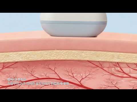 [연구소개] 김철홍 교수(BOA Lab) - 차세대 초고속 혈류 초음파 영상 기술