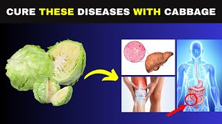Top 9 Diseases You Can Treat With Cabbage