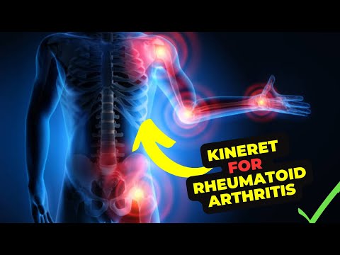 Kineret Injections: How They Work, Benefits, and Side Effects Explained