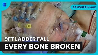 Builder's 9ft Fall Breaks Multiple Bones at St George's | 24 Hours In A&E