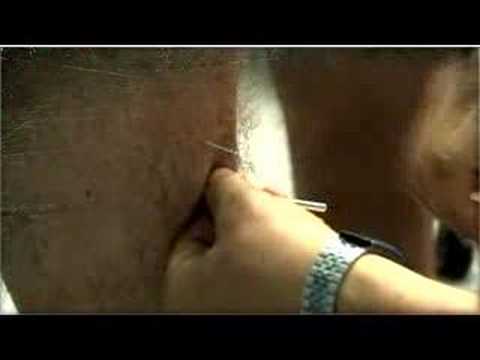 Burmariders - Tag 1 - Akkupunktur