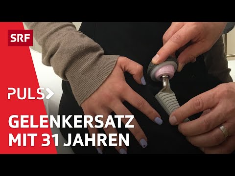 Arthrose: Was hilft gegen den schmerzhaften Knorpelabbau in Knie und Hüfte? | Puls | SRF Wissen