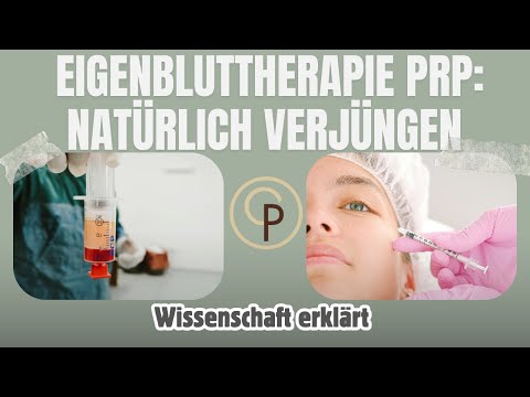 PRP: Was ist Eigenbluttherapie & wie verjüngt sie?