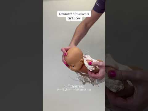 Cardinal Movements of Labor #givingbirth #childbirtheducation #pregnancyinformation #expectingmom