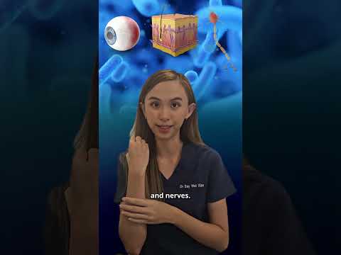 Dr Say Says… Leprosy is NOT just ancient history! 🤔