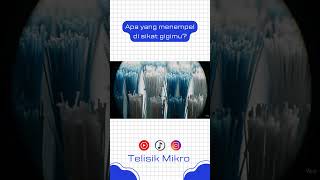 Download lagu Apa yang menempel di sikat gigimu mp3 Download lagu Apa yang menempel di sikat gigimu mp3