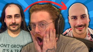 Bald Transformations Are MINDBLOWING