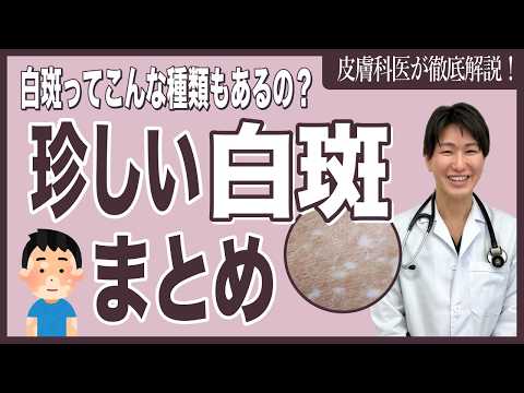 尋常性白斑の治療について医師が解説